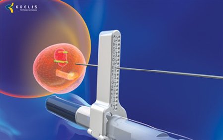 05 transperineal biopsy