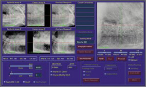 CyberKnife® CyberKnife®